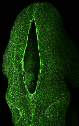 The neural tube